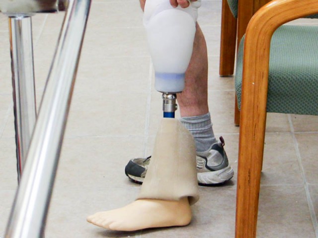 Lower Extremity Prosthetics | East Coast Orthotic & Prosthetic Corp.